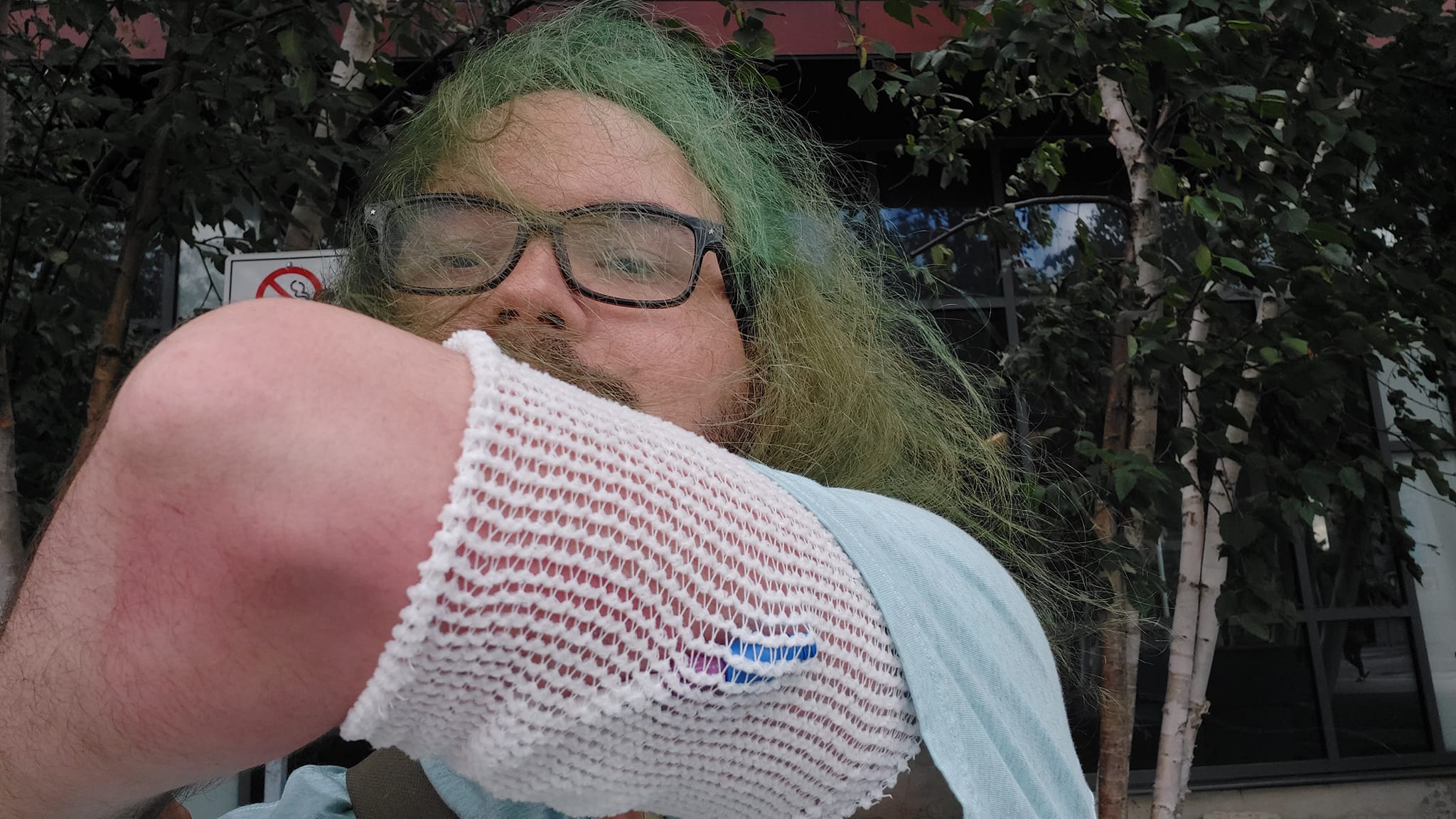 A man with green hair and a beard is in street clothes outside the hospital, showing off the mesh again